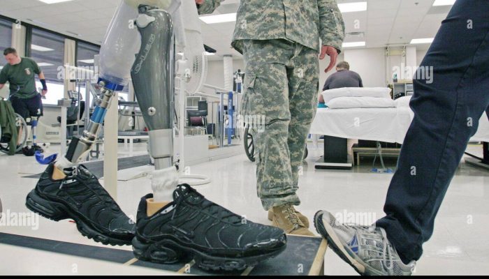 double-leg-amputee-bradley-walker-goes-through-physical-therapy-to-get-used-to-a-new-computerized-c-leg-prosthetic-leg-at-walter-reed-army-medical-center